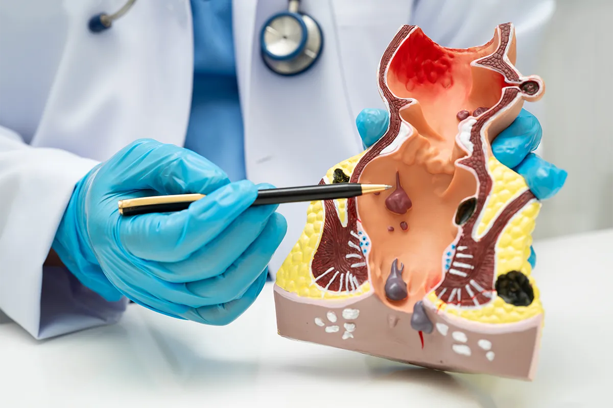 Service de Chirurgie viscérale au Centre Hospitalier de Carcassonne