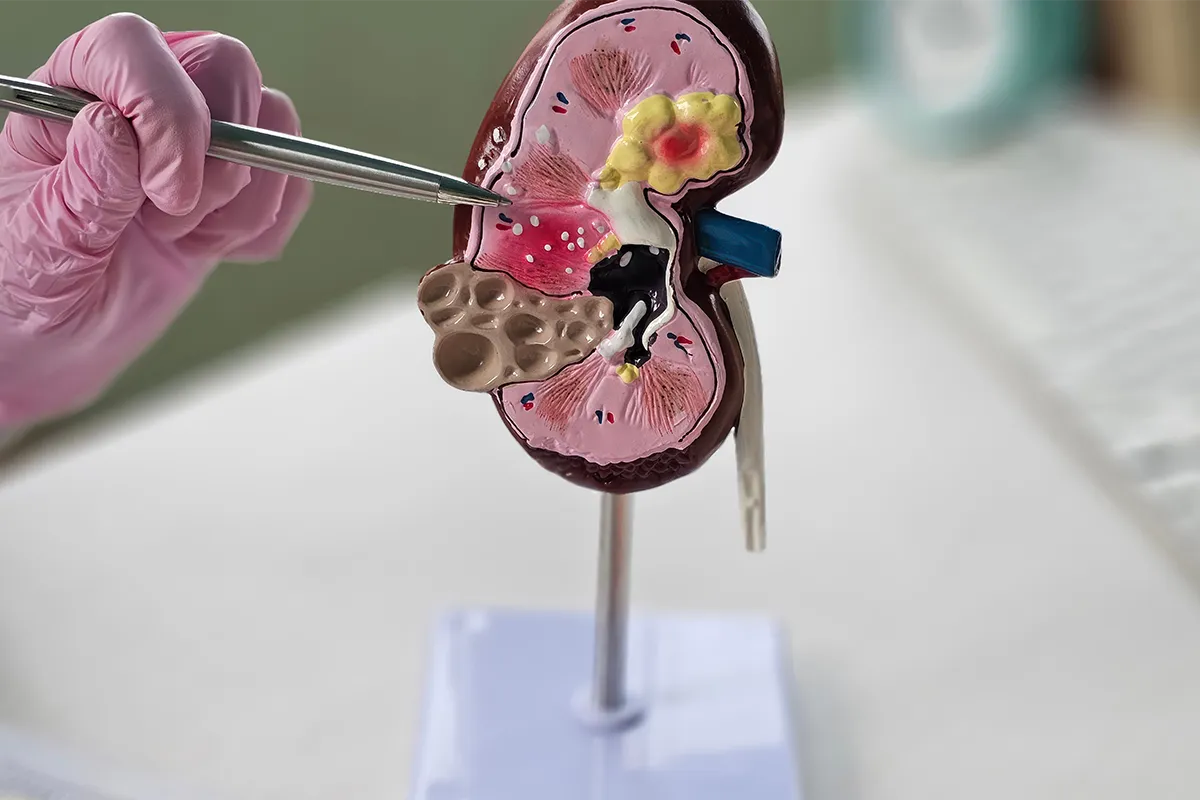 Consultation de Nephrologie