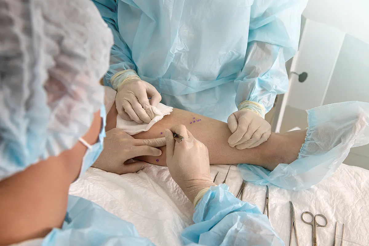 Consultation de Chirurgie Vasculaire