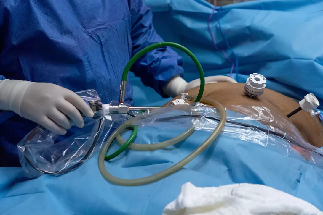 Le parcours obésité au Centre Hospitalier de Carcassonne